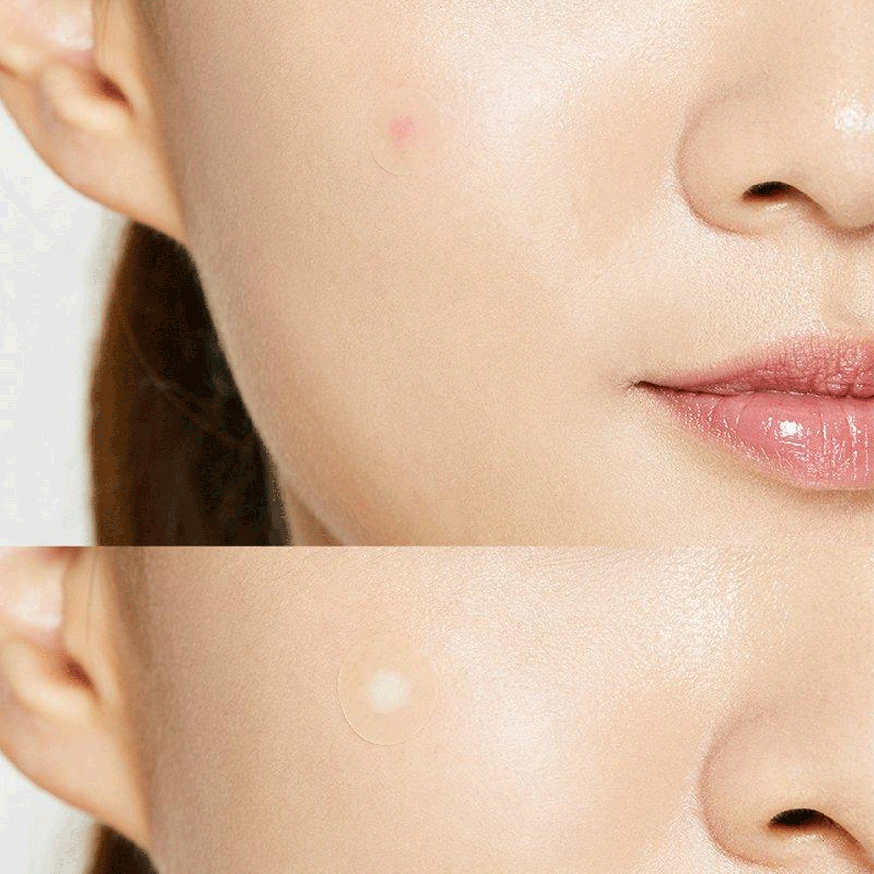 Acne Pimple Master Patch